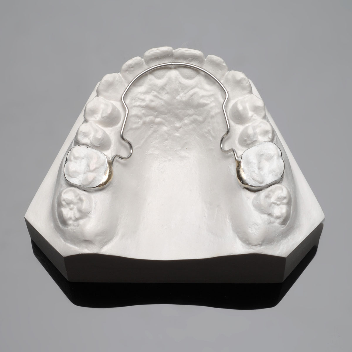 Incognito Lingual Braces Braces Treatment In Taree Taree Orthodontics