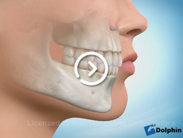 Look after your teeth and braces