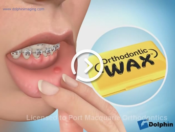 Wax patient comfort