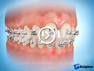 Elastomeric ligation