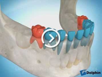 Deciduous teeth