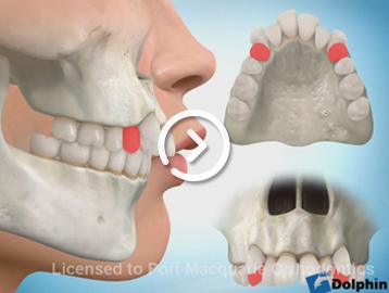 Lip posture