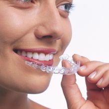 Invisalign Teen